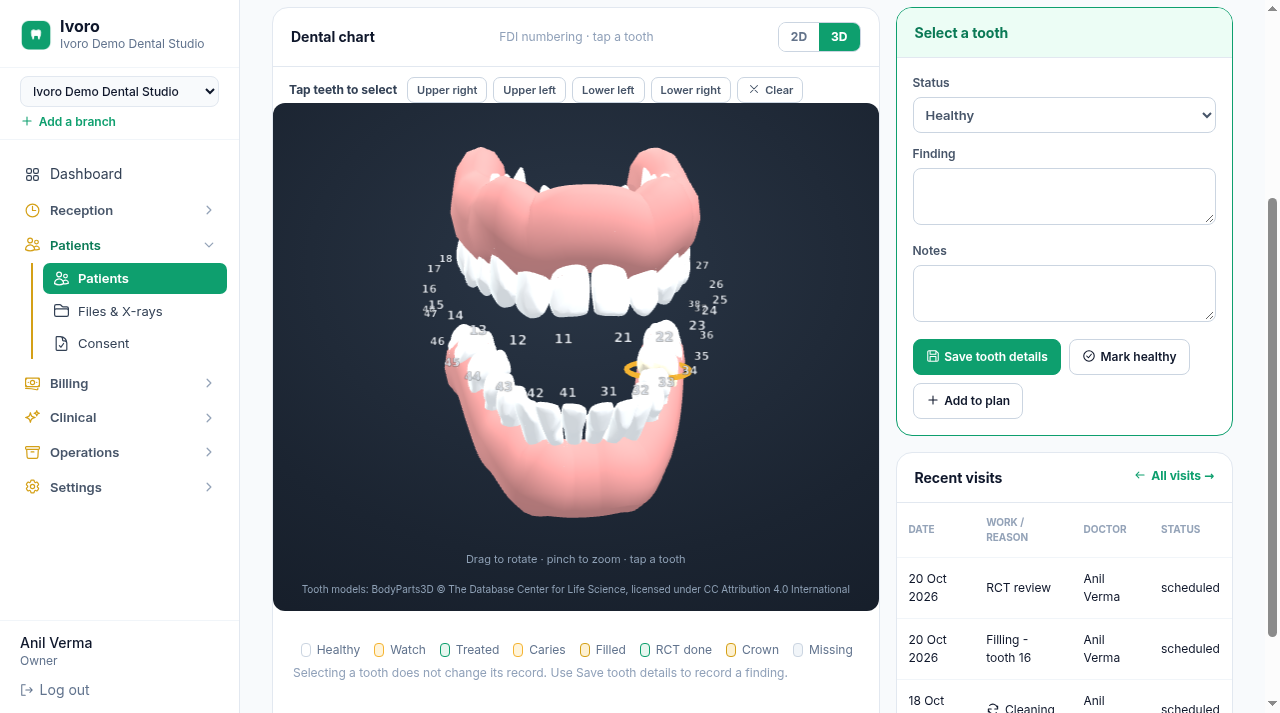 Realistic 3D dental chart with all 32 FDI-numbered teeth, drag to rotate